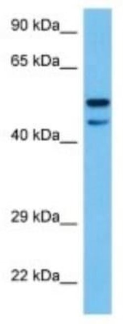 FAM149B1 Rabbit anti-Mouse, Polyclonal, Novus Biologicals 100 &mu;g | Buy Online | Novus Biologicals | Fisher Scientific